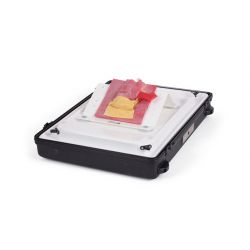 Vermiform appendix - post-ileal