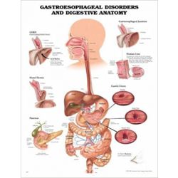 Wandplaat 'Gastroesophagel Disorders' 