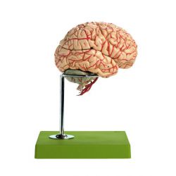 Hersenen met arteriën, 9-delig