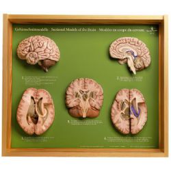 Hersendoorsnede-modellen, set van 5