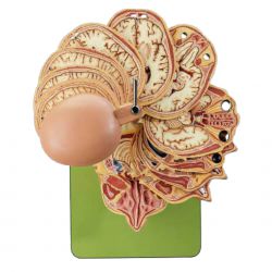 Horizontale doorsnede van het hoofd, niveau 5