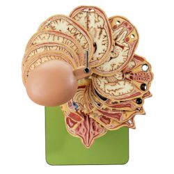 Horizontale doorsn. van het hoofd (CT/MR-opnamen), 10 niveau