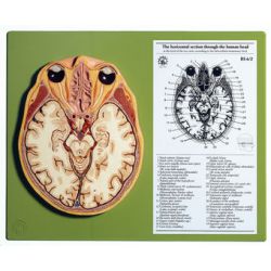 Horizontale doorsnede van het hoofd, op oogkas niveau 2