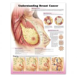 Wandplaat 'Understanding Breast Cancer'