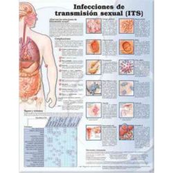 Wandplaat 'Sexually Transmitted Infections' 