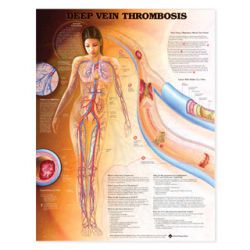 Wandplaat 'Vein Thrombosis' 