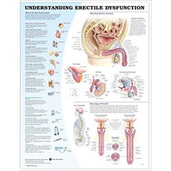 Wandplaat 'Understanding Erectile Disfunction' 