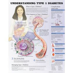 Wandplaat 'Understanding Type 1 Diabetes'