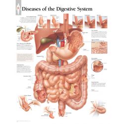 Wandplaat 'Diseases of the Digestive System'