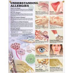 Wandplaat 'Understanding Allergies'