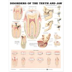 Wandplaat 'Disorders of the Teeth & Jaw' 