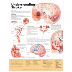 Wandplaat 'Understanding Stroke'