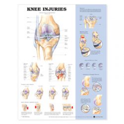 Wandplaat 'Knee Injuries'