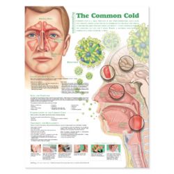 Wandplaat 'Understanding the Common Cold'