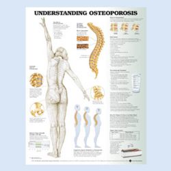Wandplaat 'Understanding Osteoporosis'