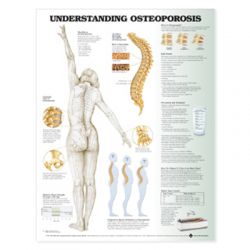 Wandplaat 'Understanding Osteoporosis'