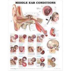 Wandplaat 'Middle Ear Conditions' 