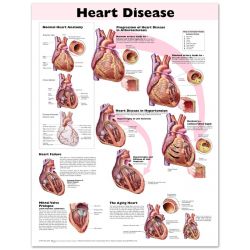 Wandplaat 'Heart Disease'