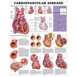 Wandplaat 'Cardiovascular Disease'