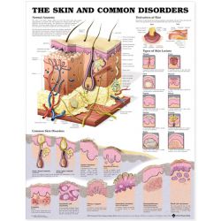 Wandplaat 'The Skin and common disorders'