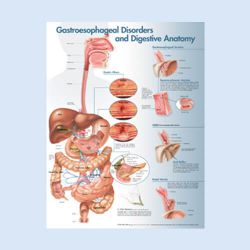Wandplaat 'Gastroesophagel Disorders' 