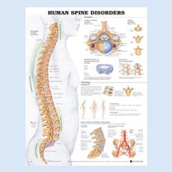 Wandplaat 'The Human Spine - Disorders'