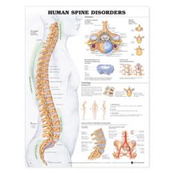 Wandplaat 'The Human Spine - Disorders'