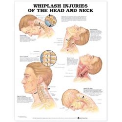 Wandplaat 'Whiplash Injuries of the Head & Neck'