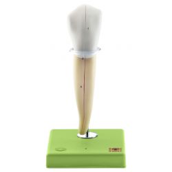 Hoektand onder, 8x vergroot, 2-delig