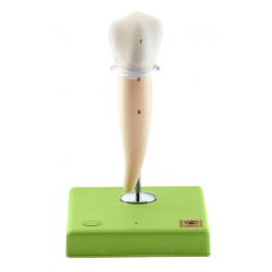 Valse onderkies met 1 wortel, 8x vergroot