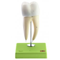 Onderkies met 2 wortels, 8x vergroot, 3-delig