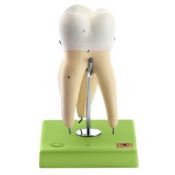 Onderkies met 3 wortels, 8x vergroot, 3-delig