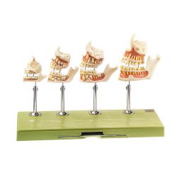 Gebitsontwikkeling, 4 stadia, natuurlijke grootte