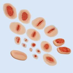Emergency Wound Kit