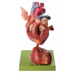 Hart, 1,5x vergroot, 4-delig