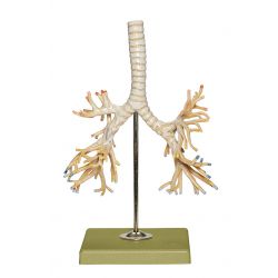 Bronchiale boom, 2/3 natuurlijke grootte