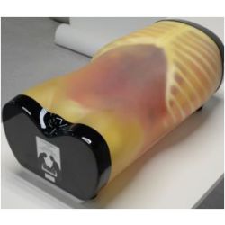 FAST/FAN  Acute Abdomen Phantom