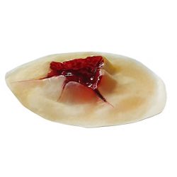 Uitschotwond, klein, latex 