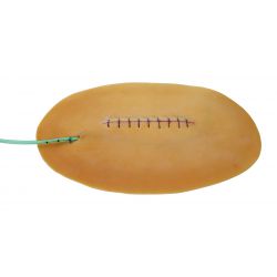 Chirurgische wond - model C met drain