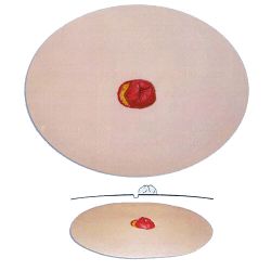 Stoma model A