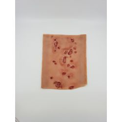 Wond "Diabetes sores on leg" sleeve