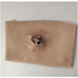 Wond door voorwerp gespiest - sleeve