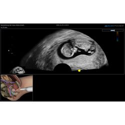 ScanTrainer "TVS/TAS-SimCenter - Module 7 – Transvaginal/Transabdominal Ultrasound Learning Package for Simulation Centers" – voor ScanTrainer  of ScanTrainer Compact