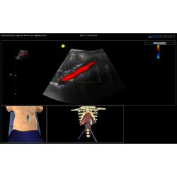 ScanTrainer TAS General Medicin - Module 5 – Transabdominaal Ultrasound Learning Package – voor ScanTrainer of ScanTrainer Compact