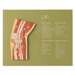 Sagittale doorsnede van de elleboog