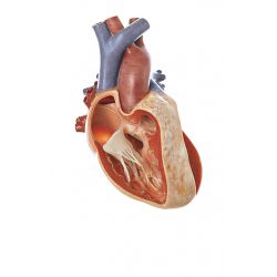 Hart met tetralogie van Fallot, 3x vergroot