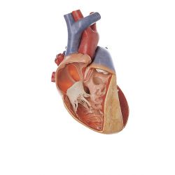 Hart met ventrikelseptumdefect, 3x vergroot