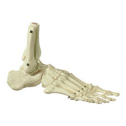 Voetskelet, star gemonteerd