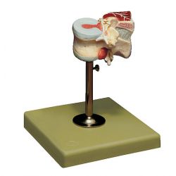 Lendewervel (L1) met tussenwervelschijf en rugspieren