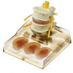 Wervel- en tussenwervelschijfmodel, 10-delig